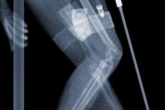 私密环图,探索人体私密部位的神秘世界